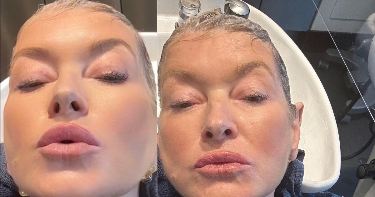 Artistic Martha Facelift Image in HD Artistic Martha Facelift Image in HD